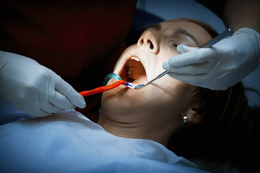 דחיסת מזון - מטופלת במרפאת שיניים בניקוי שיניים