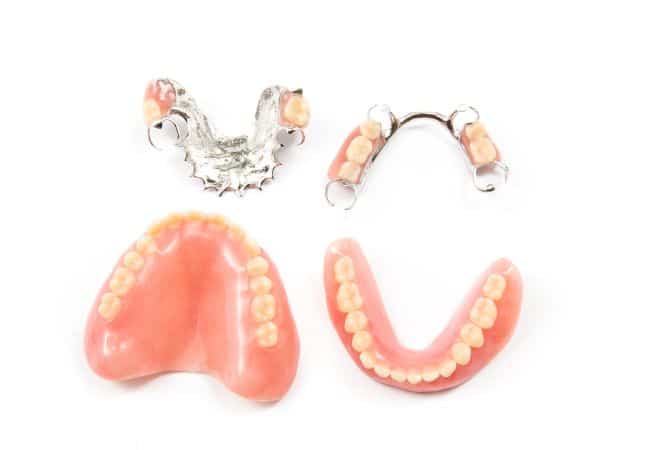 סוגי שיניים תותבות